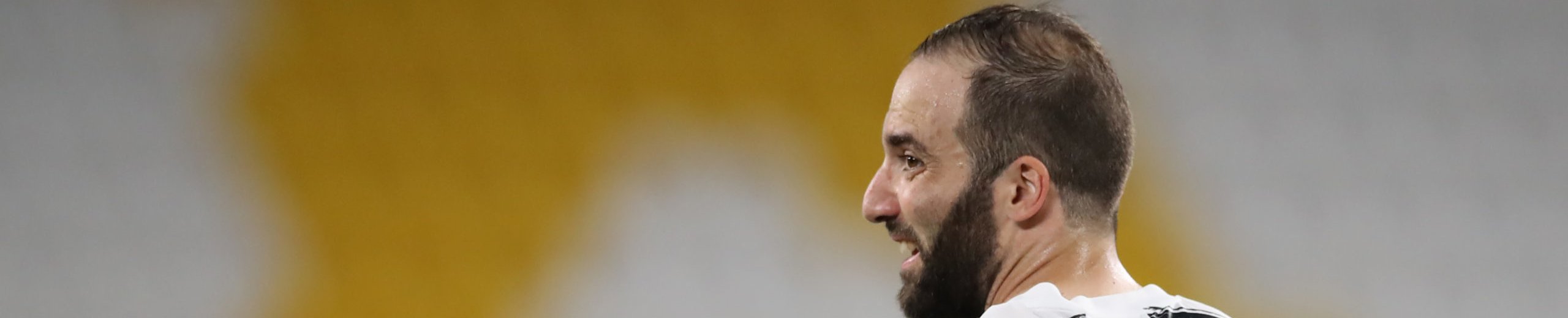 Pronostico Juventus-Lione, Sarri si affida a Higuain: ultimissime e probabili formazioni